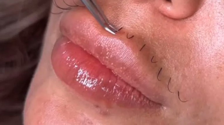 Novi beauty trend: Žene masovno rade nadogradnju brkova