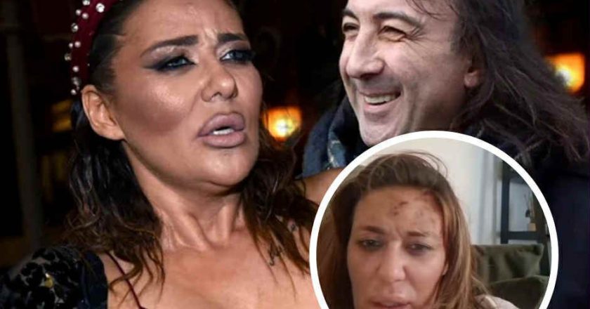 Ana Nikolić pretučena: Video objava šokirala javnost