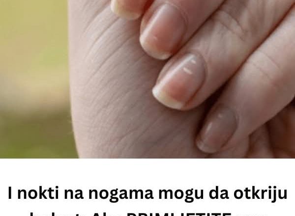 Šta vaši nokti govore o zdravlju: Promjene koje ne treba ignorisati