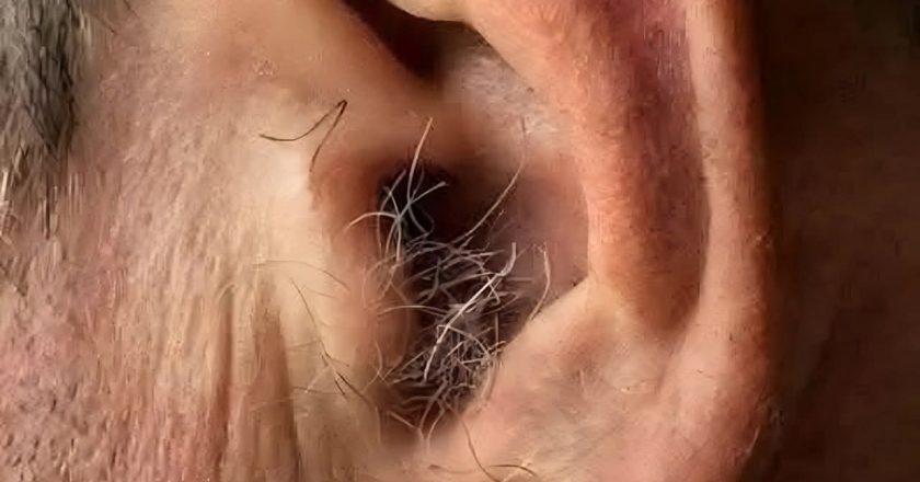 Da li ste znali? Ako vam dlake rastu iz ušiju, to može biti znak…
