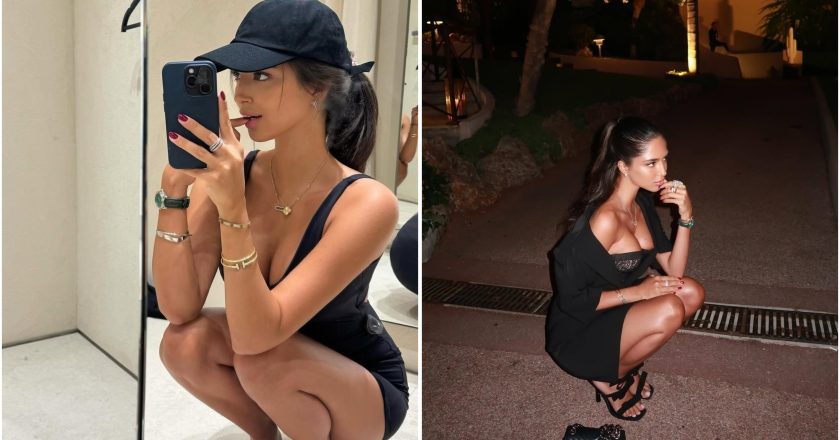 Đina Džinović i estetske promjene: Da li je ugradila silikone?