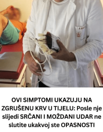 OVI SIMPTOMI UKAZUJU NA ZGRUŠENU KRV U TIJELU: Posle nje slijedi SRČANI I MOŽDANI UDAR ne slutite ukakvoj ste OPASNOSTI