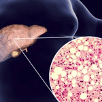 Bolje od surutke: Samo 50g ove namirnice dnevno čisti jetru i izbacuje toksine