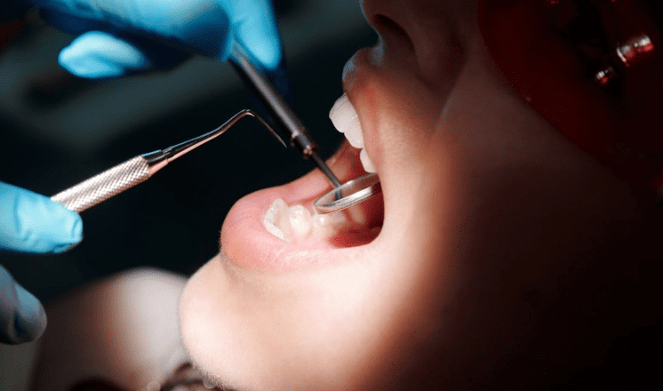 Djevojka umrla nakon vađenja umnjaka u Srbiji: Tužilaštvo hitno naložilo obdukciju