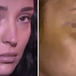 Horor u BiH: Pretukao djevojku jer ga je odbila, policija tražila da se umije kako bi provjerili da nije šminka