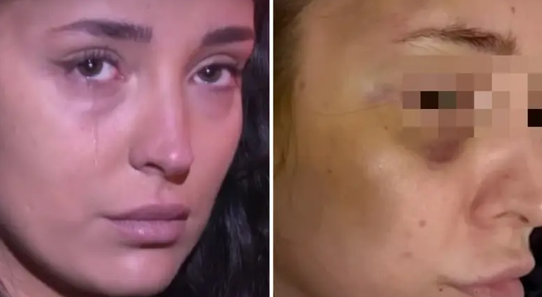 Horor u BiH: Pretukao djevojku jer ga je odbila, policija tražila da se umije kako bi provjerili da nije šminka