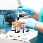 Opasni virus procurio iz laboratorije