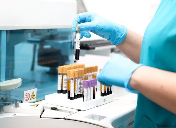 Opasni virus procurio iz laboratorije