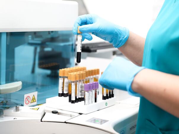 Opasni virus procurio iz laboratorije