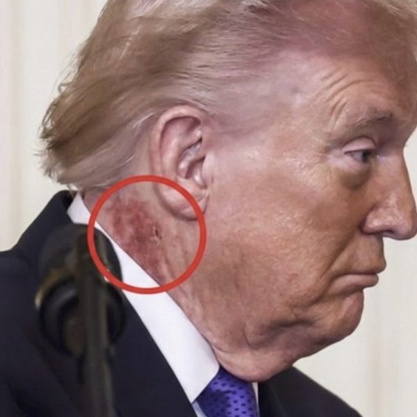 Širi se fotografija crvene mrlje na vratu Donalda Trumpa, oglasila se Bijela kuća